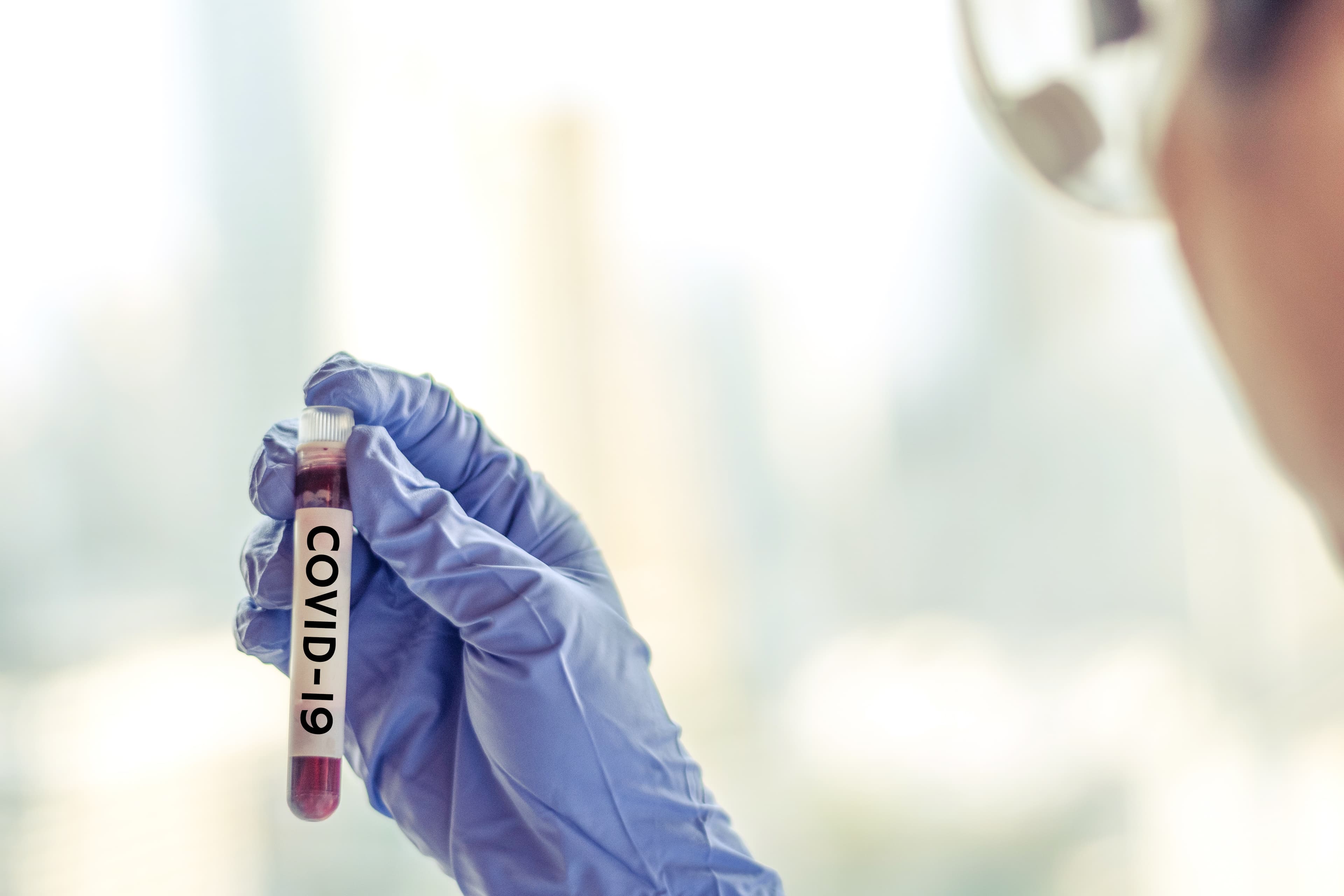 COVID-19 Novel coronavirus NCP concept. Professional doctor or lab technician holding blood sample with novel (new) coronavirus N.C.P. first identified in Wuhan, Hubei Province, China, medical and healthcare